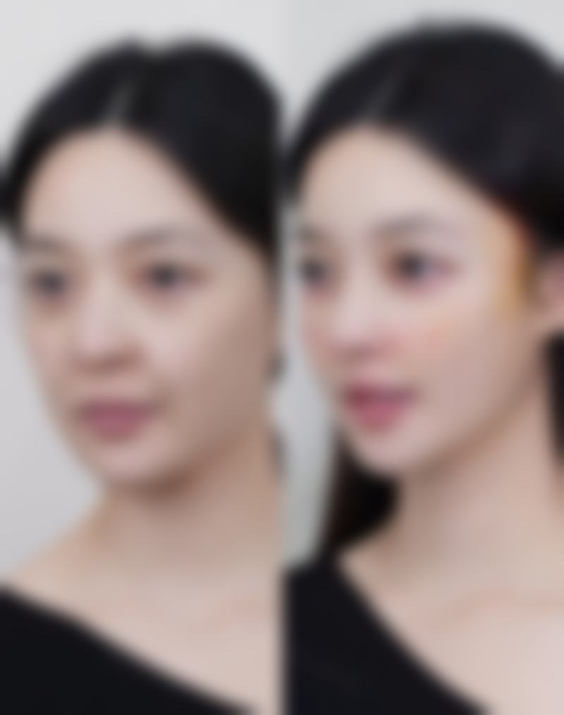 长治悦美整形价格收费