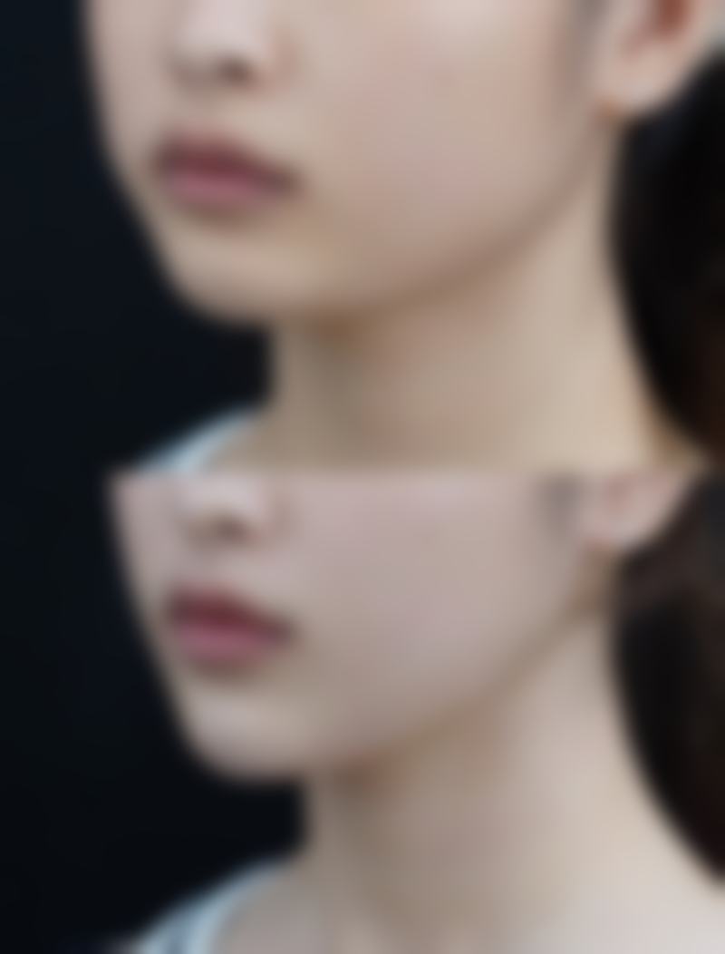 桐乡甄美龄整形医院特色项目及技术优势