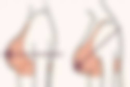 韩国Brandnew整形外科求美者反馈