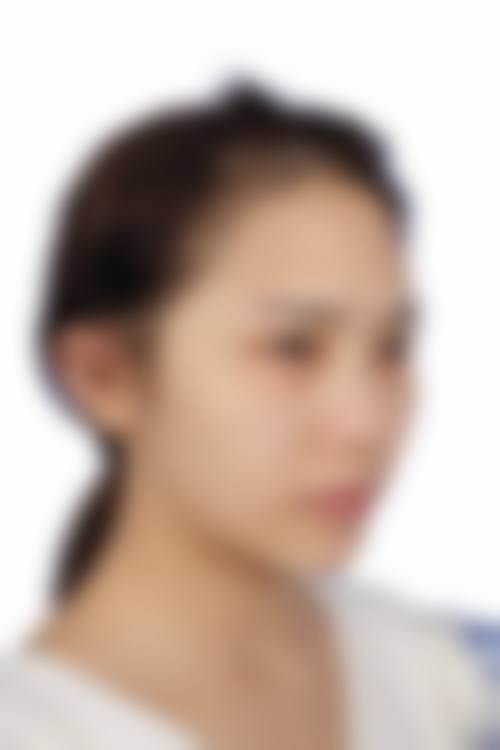 宁德市闽东医院烧伤整形外科价格收费