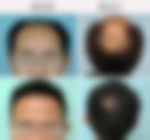 林飞鸿医师依托的专精医美服务标准