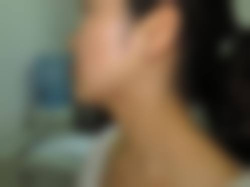 厦门银河整形医院价格收费