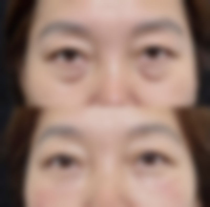 长春海峡整形美容医院特色项目及技术优势