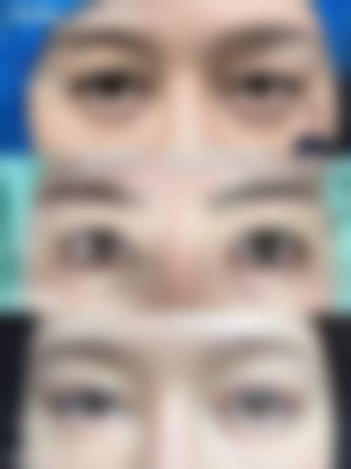 仙台Eye美容外科价格收费