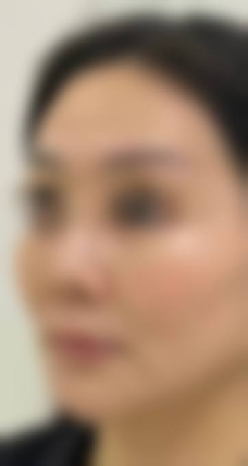 沈阳孙晓莹医疗整形美容价格收费
