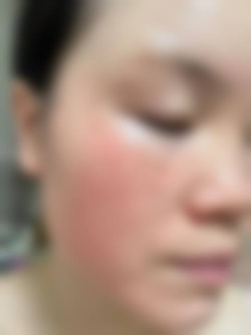 李万福依托专精设备打造可靠医美体验