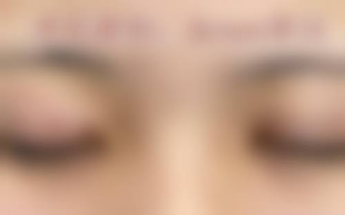 仙台Eye美容外科特色项目及技术优势