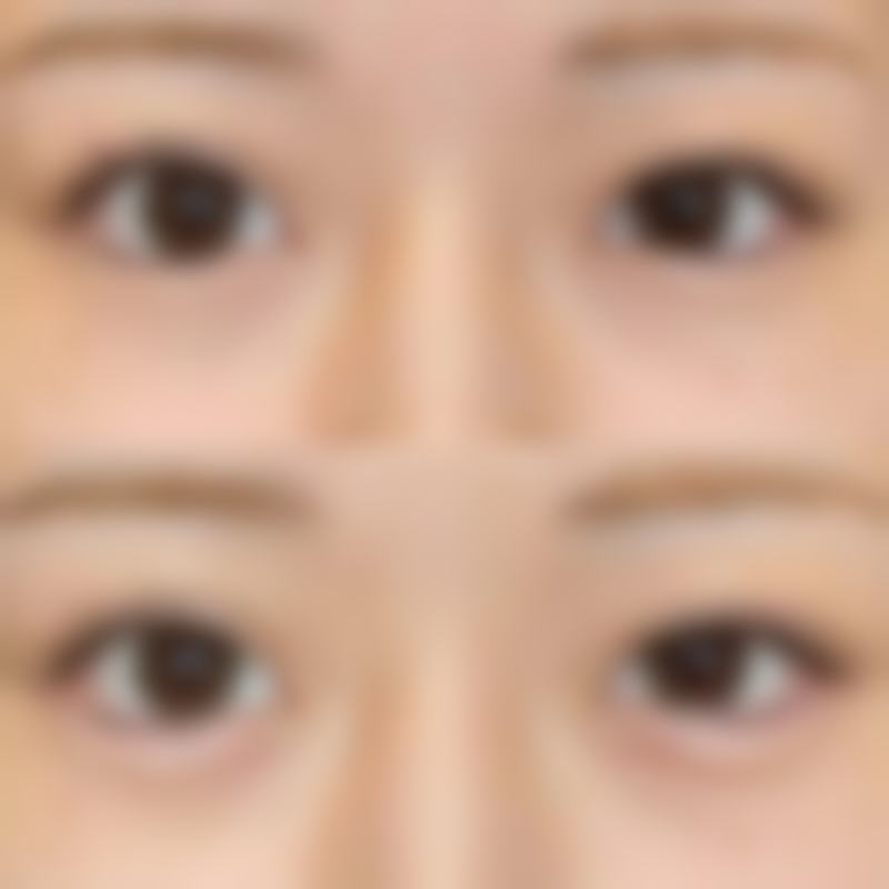 海口尚氏整形医院来院路线