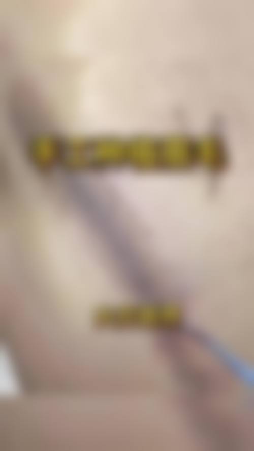 海南丁文杰医疗美容门诊部求美者反馈