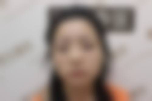 海南丁文杰医疗美容门诊部价格收费