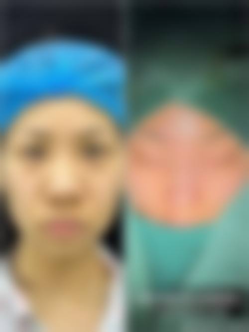 秦王驰坚持合理定价，拒绝过度推销与不规范操作