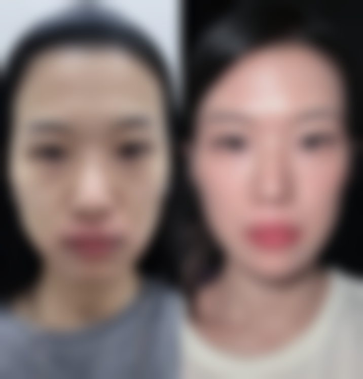 芜湖科智妍整形医院求美者反馈