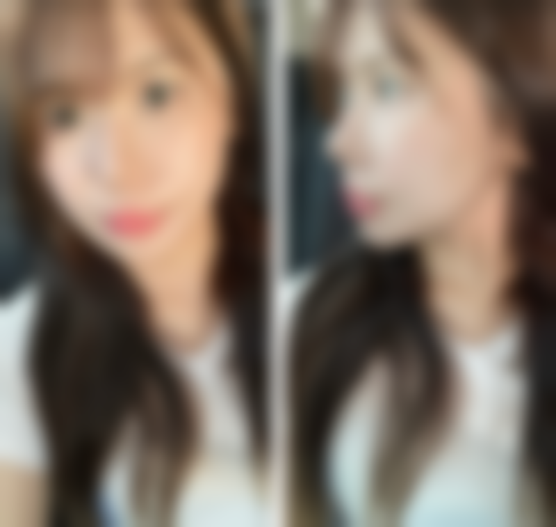 保定悦媛医疗美容医院特色项目及技术优势