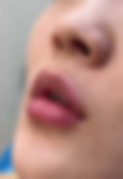 无锡臻美卉整形医院来院路线