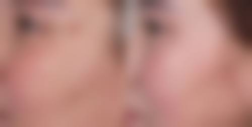 成都市第七人民医院医学整形美容科特色项目及技术优势