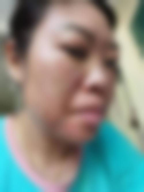 温州乐美整形医疗美容医院价格收费