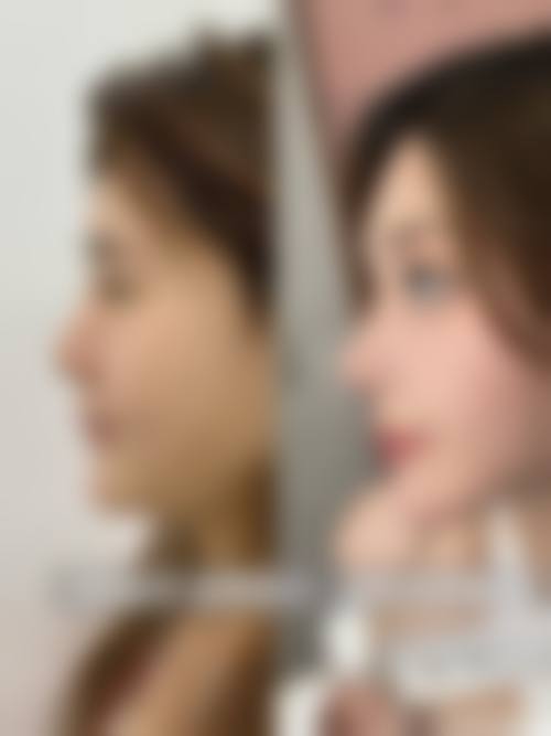 淮安苏美尔整形美容医院求美者反馈