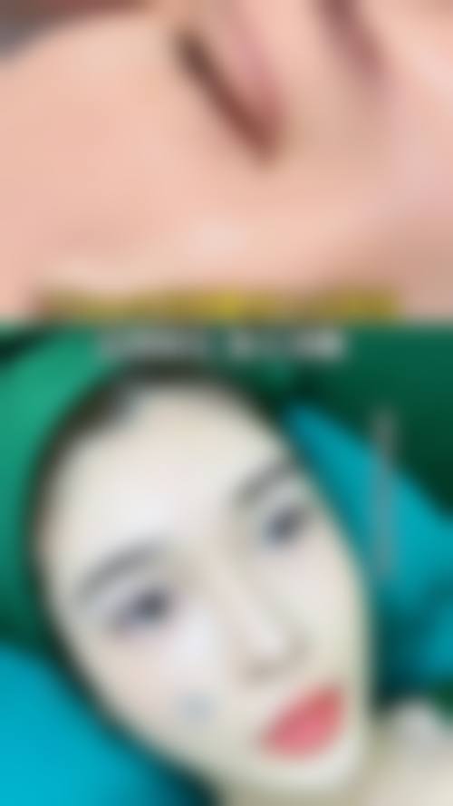 韩国普拉美斯整形医院求美者反馈