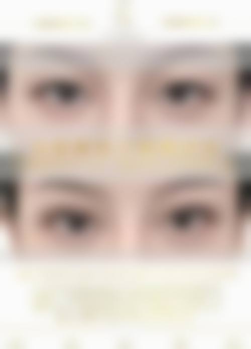 滕州美贝莱医疗美容诊所特色项目及技术优势