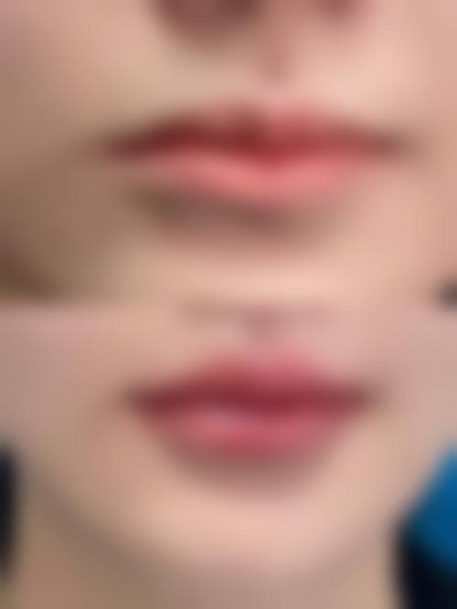 昆明美中美医疗整形美容诊所特色项目及技术优势