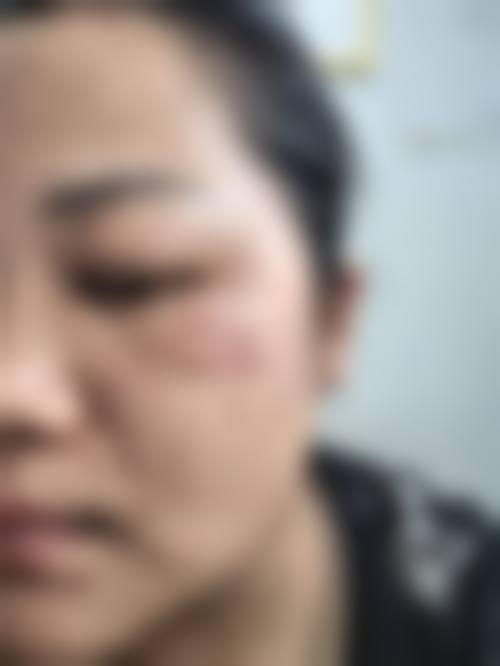 滕州美贝莱医疗美容诊所价格收费