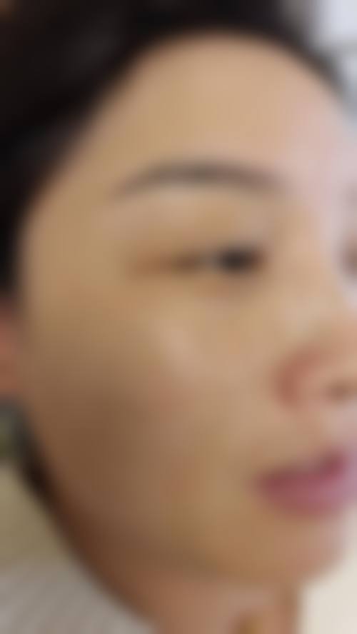 滕州美贝莱医疗美容诊所求美者反馈