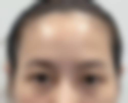 韩国普拉美斯整形医院价格收费