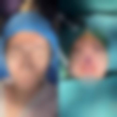 张清峰医生擅长的全品类医美项目解析