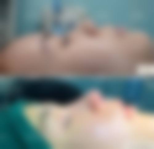 奏之杜铃兰特色项目及技术优势