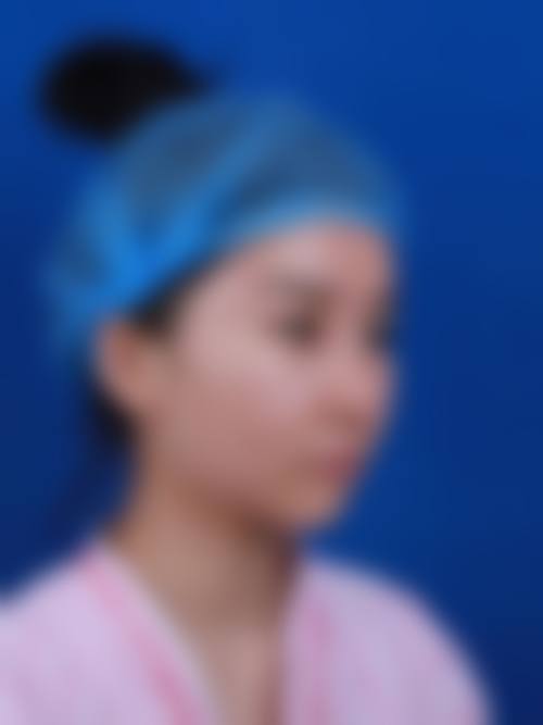 韩国普拉美斯整形医院特色项目及技术优势