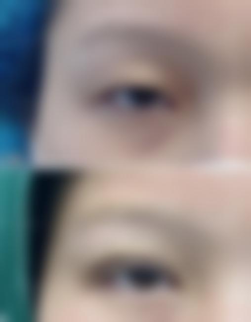 四川革命伤残军人医院价格收费