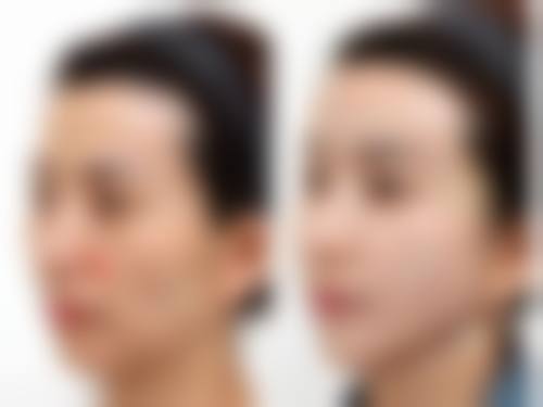 河北保定白沟姮美整形医疗美容中 心来院路线