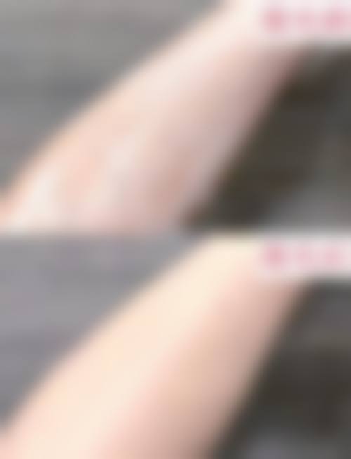 皮超主事医师覆盖的核心诊疗与医美项目