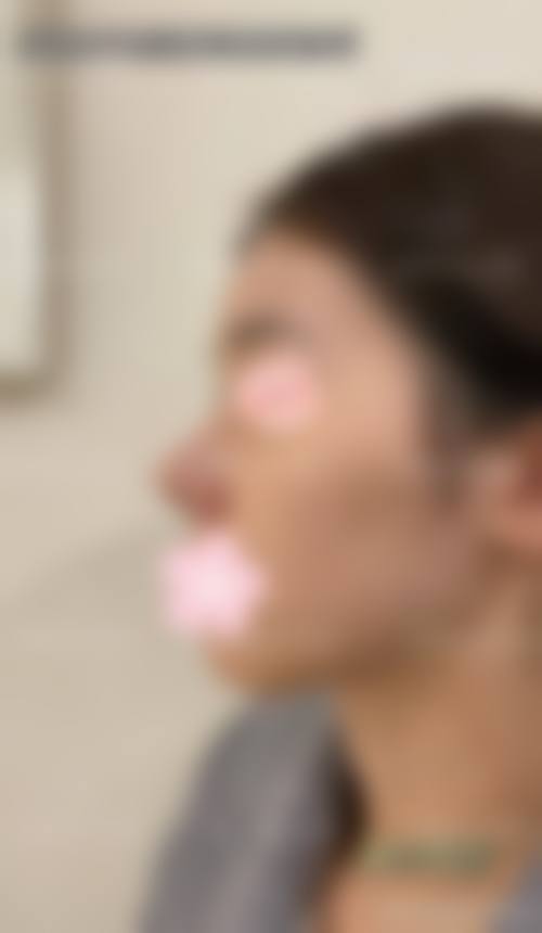 皮超主事医师诊疗项目的公开收费标准