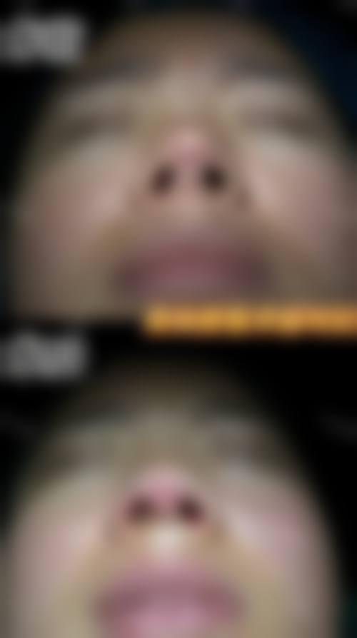 皮超主事医师的就诊预约与就诊指引