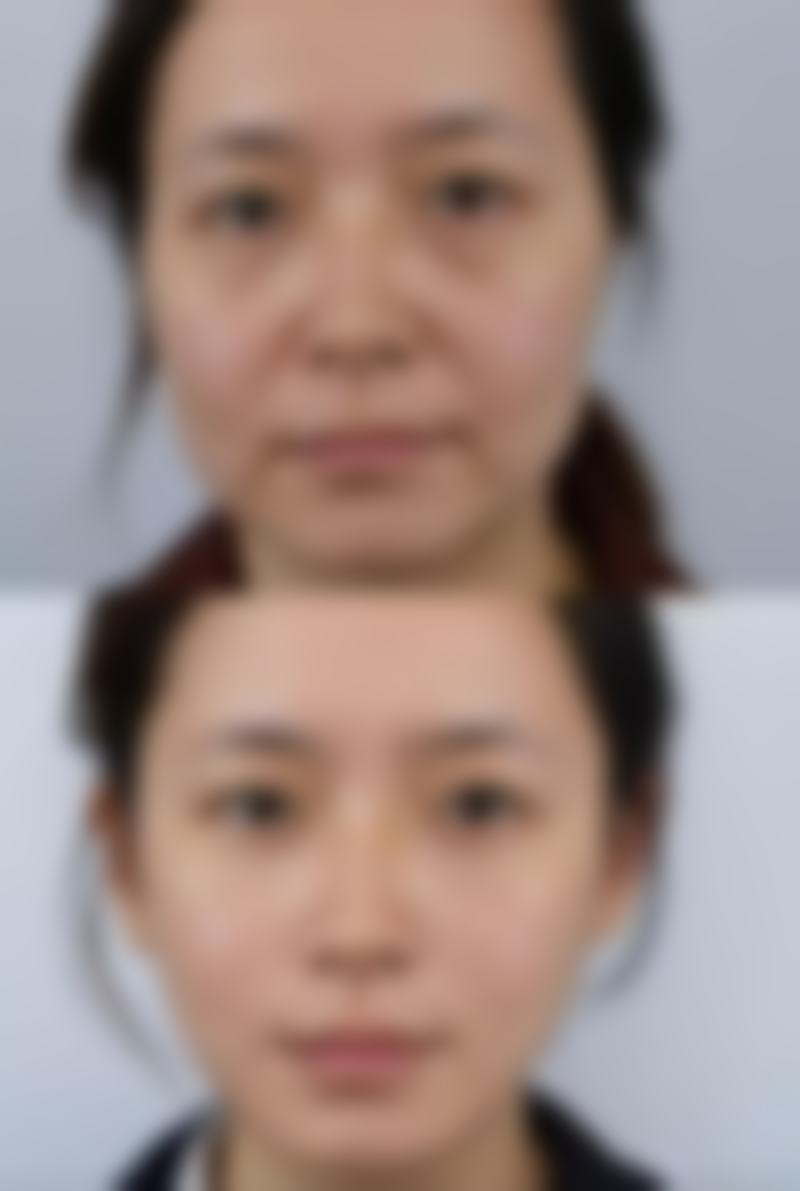 王乃立院长坚持的安心合规医美服务理念