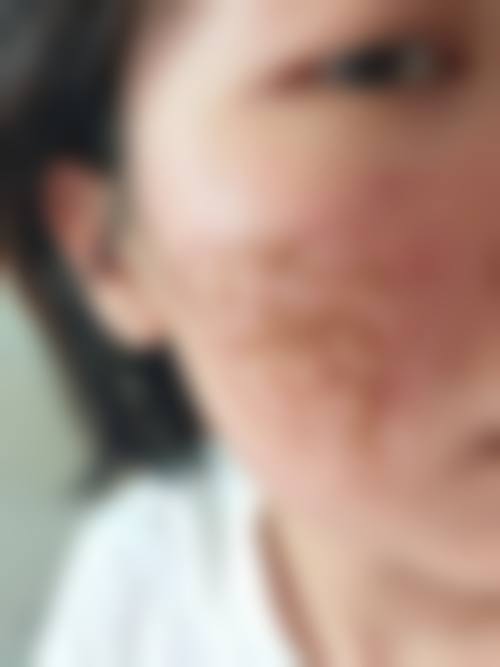 武汉美加立芳医疗美容门诊部求美者反馈