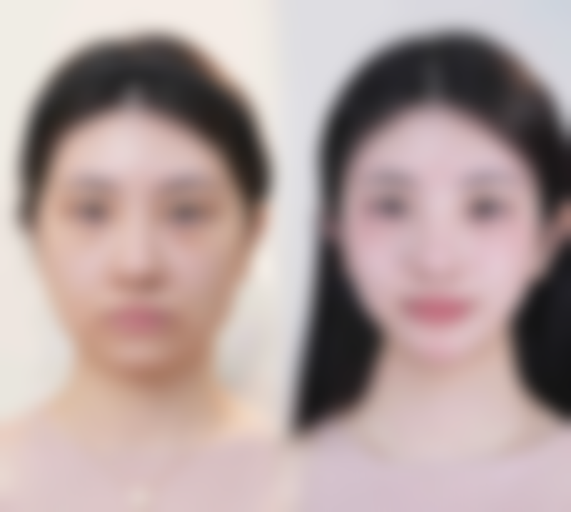 武汉九州薇美整形医院求美者反馈