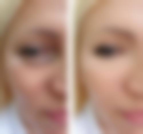 焦作名流整形医疗美容诊所求美者反馈