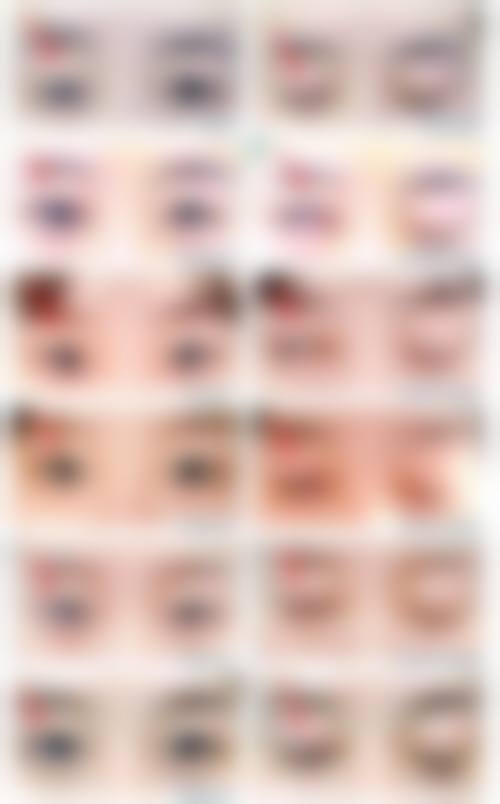 宁德霞浦康明医院医疗美容科求美者反馈