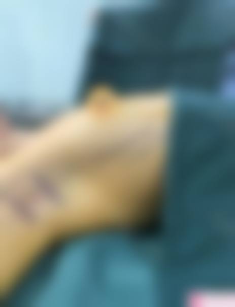 宁德霞浦康明医院医疗美容科价格收费