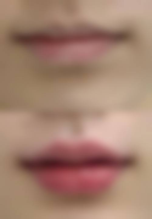 天津艾丽苏蔓医疗美容价格收费