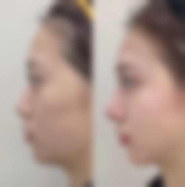 柳州医专一附院骨伤整形科简介概述