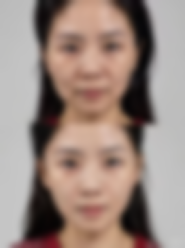 深圳栀颜整形医院价格收费