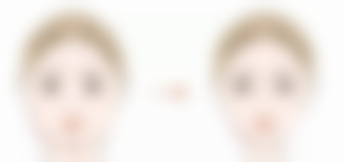 求美者真实反馈