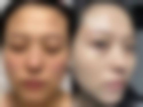 范开防医生的全周期塑美服务：从术前评估到术后修复