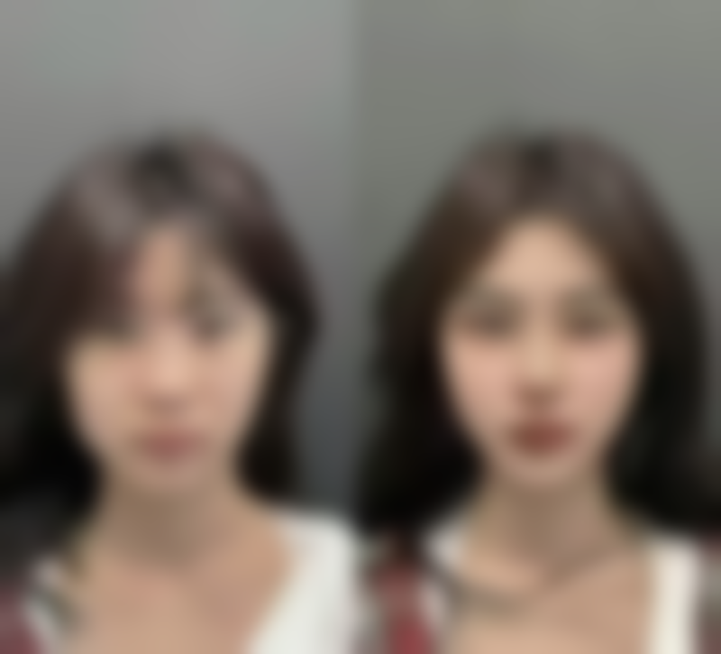 范开防医生依托正规设备与合规流程打造安心塑美体验