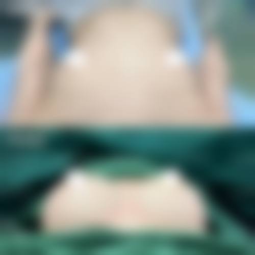 求美者真实反馈