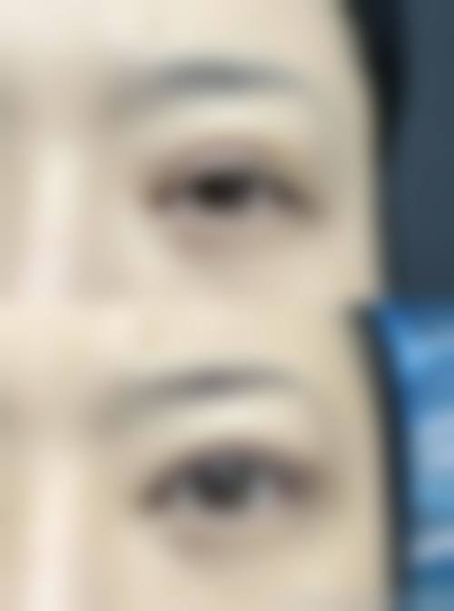 河范埈医生擅长的全品类精细化医美项目