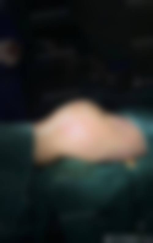 就近就诊:厦门银河整形医院,詹新华的坐诊地点